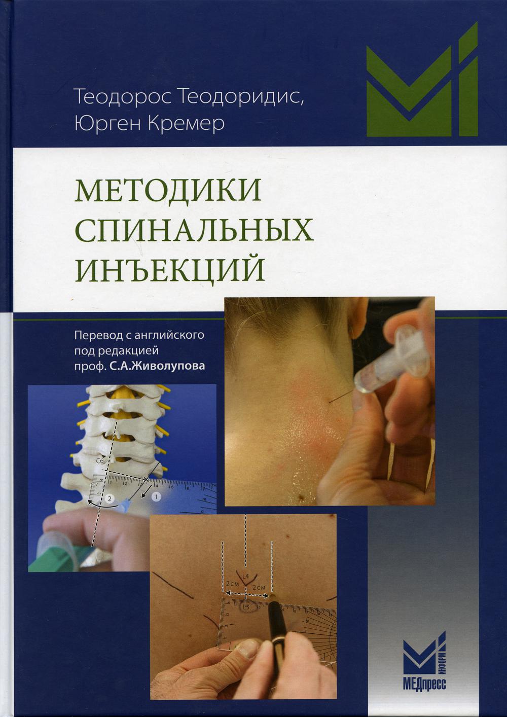 Méthodes d'injection spinale