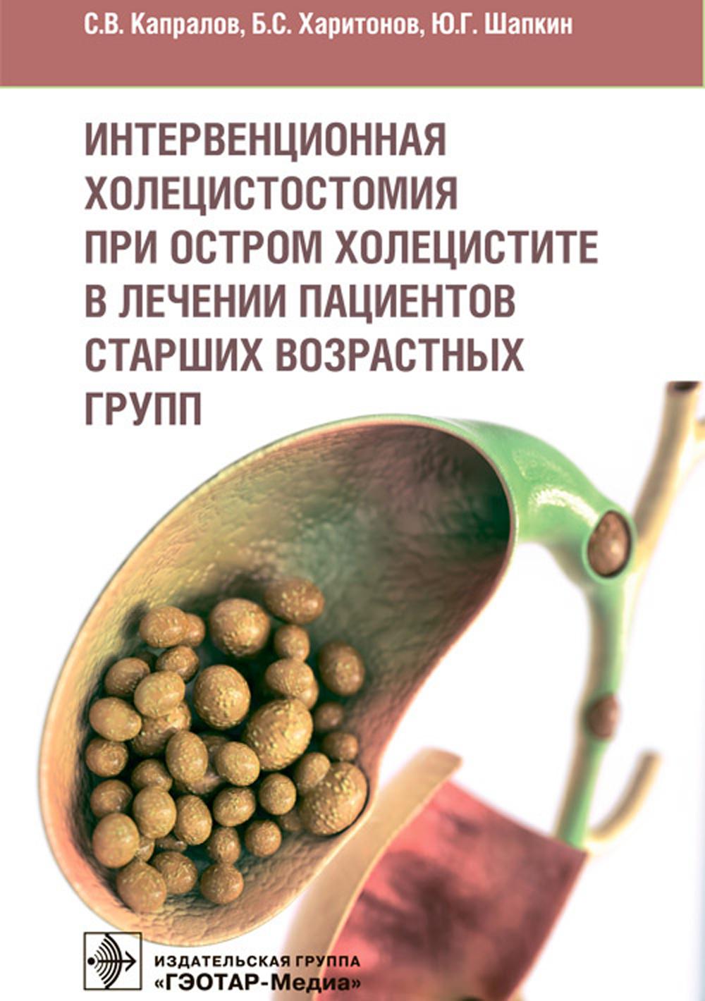 Интервенционная холецистостомия при остром холецистите в лечении пациентов старших возврастных групп