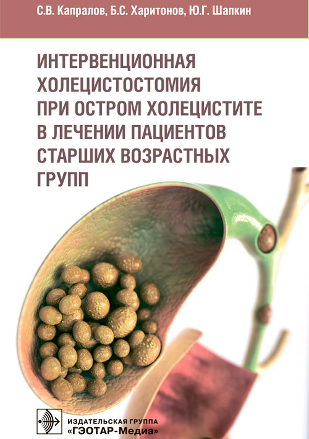 Интервенционная холецистостомия при остром холецистите в лечении пациентов старших возврастных групп