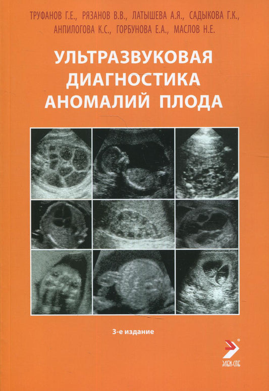 Ультразвуковая диагностика аномалий плода: Руководство для врачей. 3-ème jour
