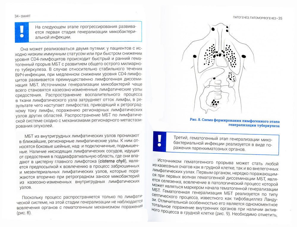 Туберкулез и ВИЧ-инфекция