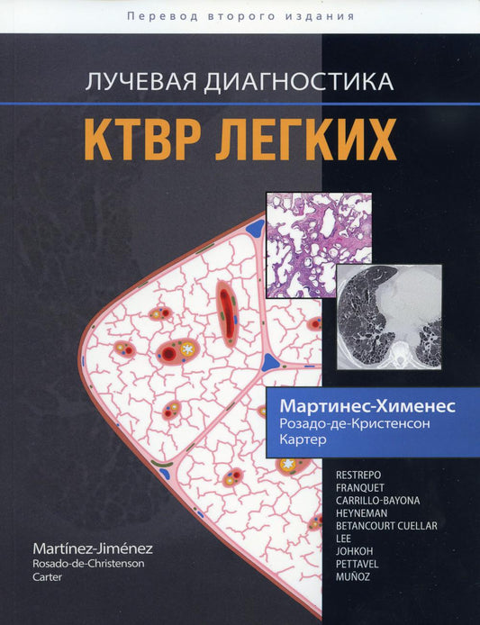 Diagnostic rapide. КТВР легких