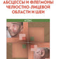 Абсцессы и флегмоны челюстно-лицевой области и шеи. Атлас: учебное пособие