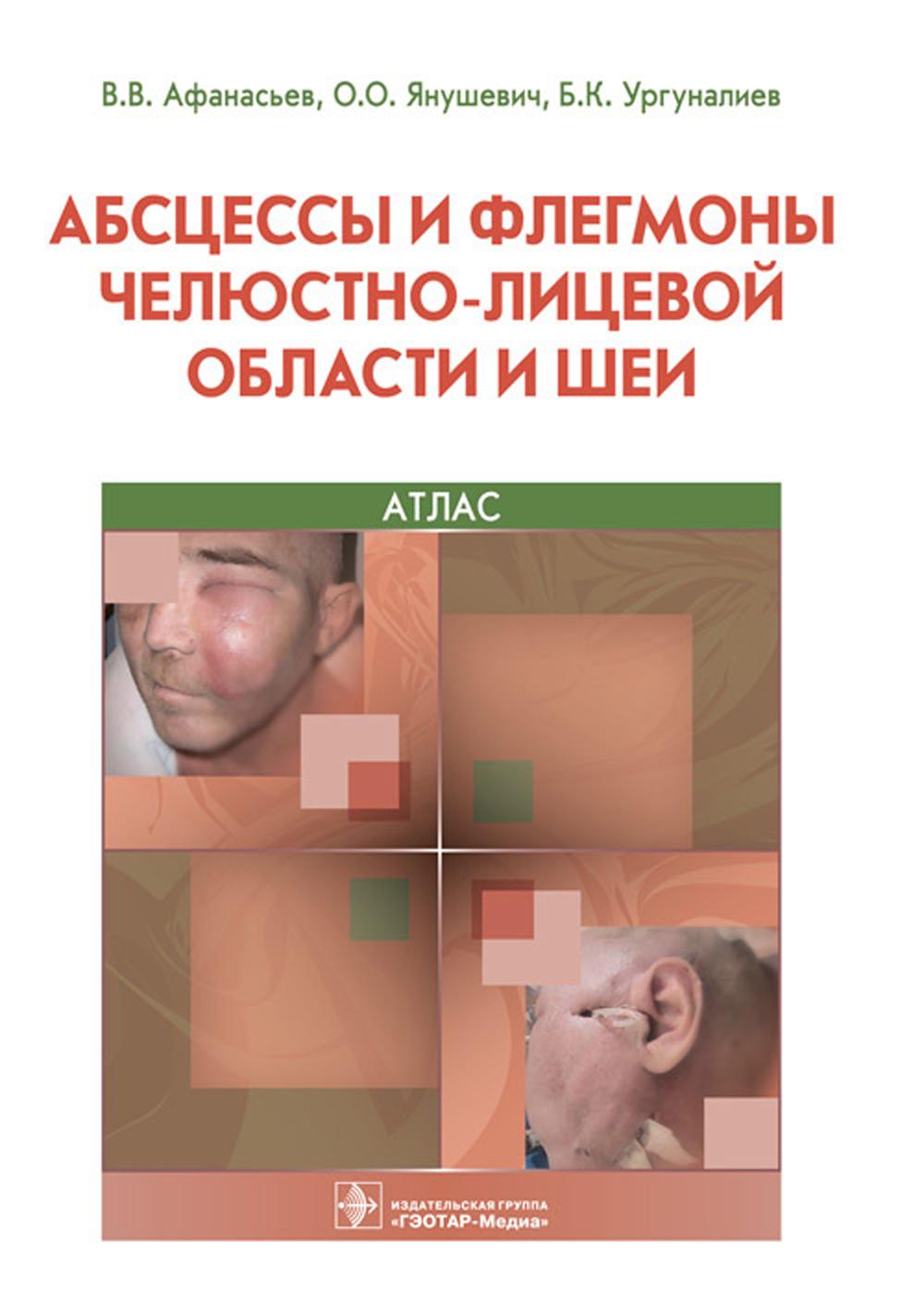 Абсцессы и флегмоны челюстно-лицевой области и шеи. Атлас: учебное пособие