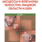 Абсцессы и флегмоны челюстно-лицевой области и шеи. Атлас: учебное пособие