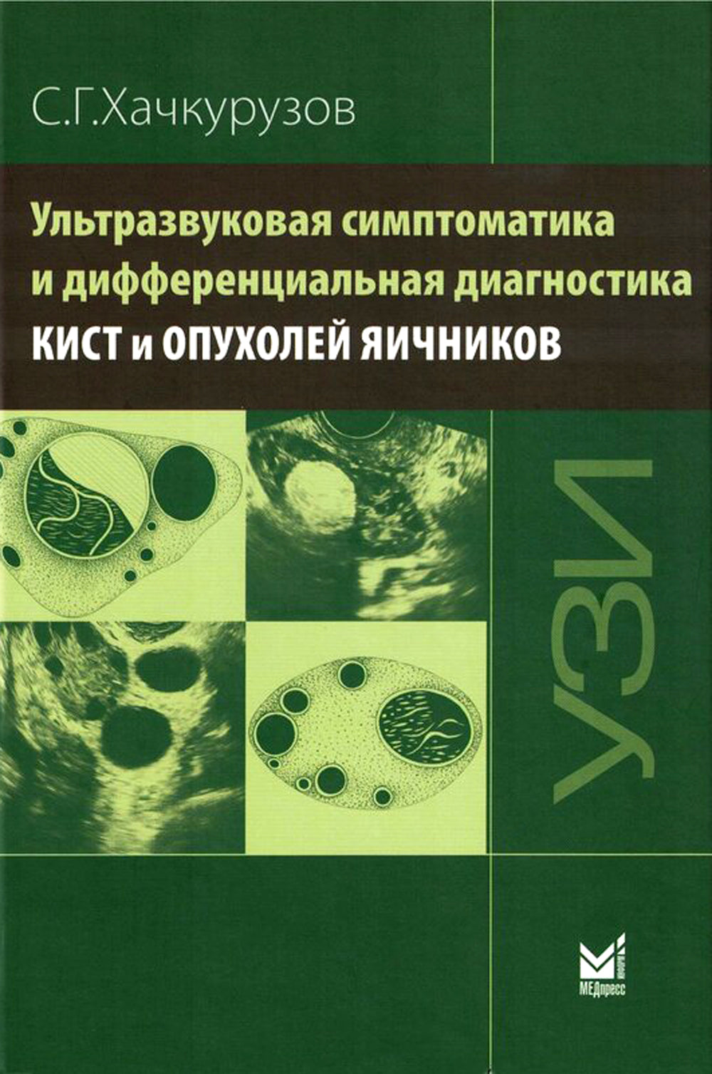 Ультразвуковая симптоматика и дифференциальная диагностика кист и опухолей яичников. 2-е изд