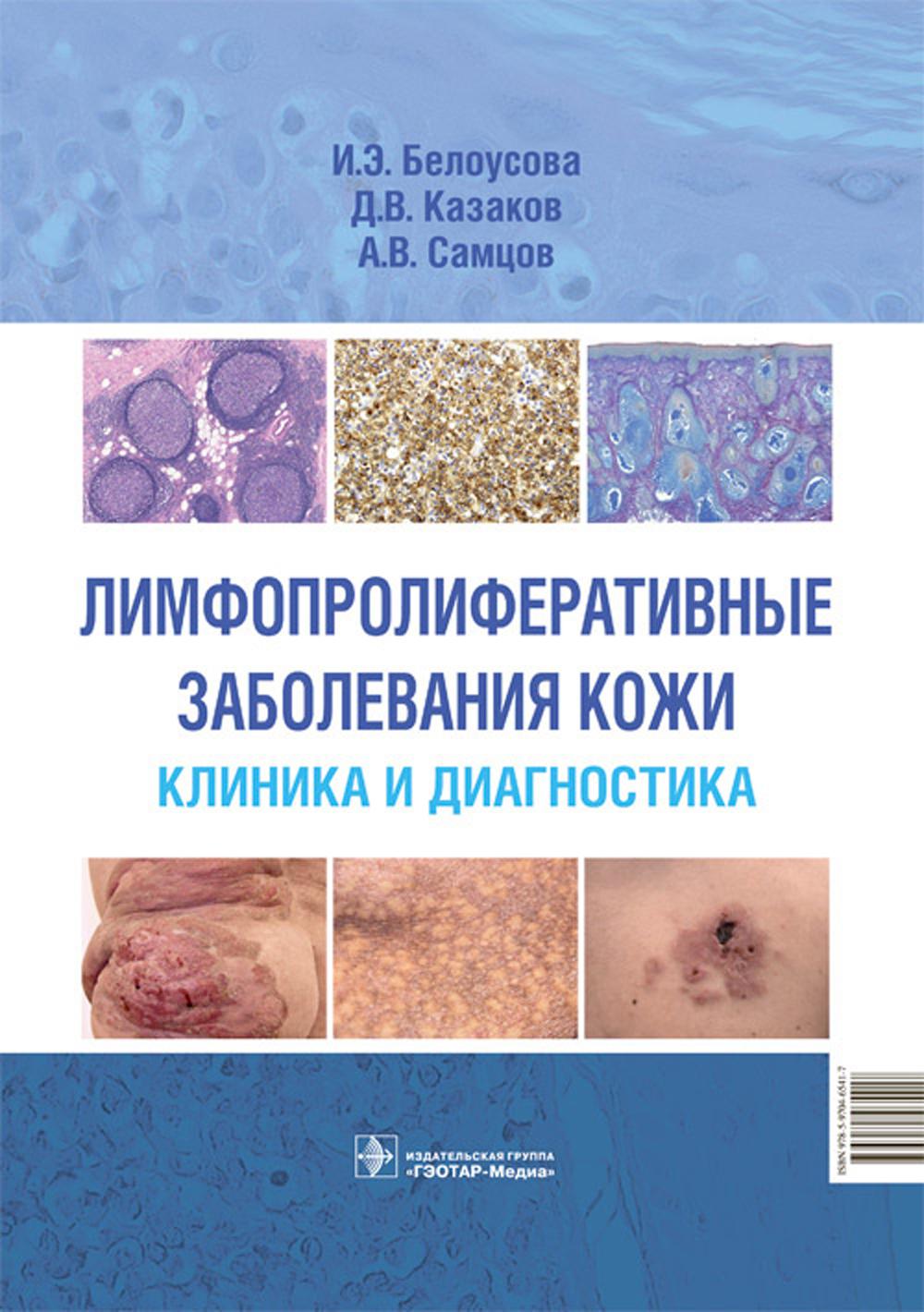 Лимфопролиферативные заболевания кожи. Clinique et diagnostic