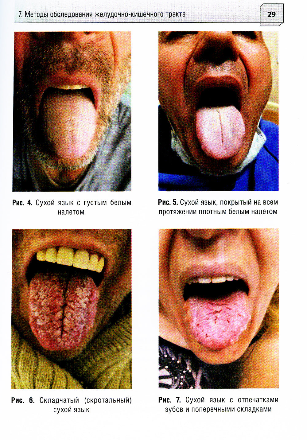 Дифференциальная диагностика диарейного синдрома в практике скорой и неотложной медицинской помощи: руководство для врачей и фельдшеров