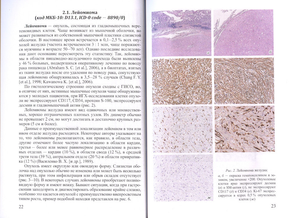 Доброкачественные опухоли желудка. Неэпителиальные  опухоли. Ч. 2: Учебно-методическое пособие