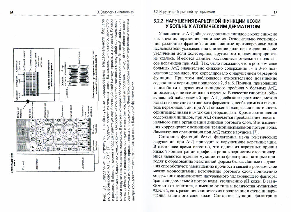 Атопический дерматит: Учебное пособие для врачей