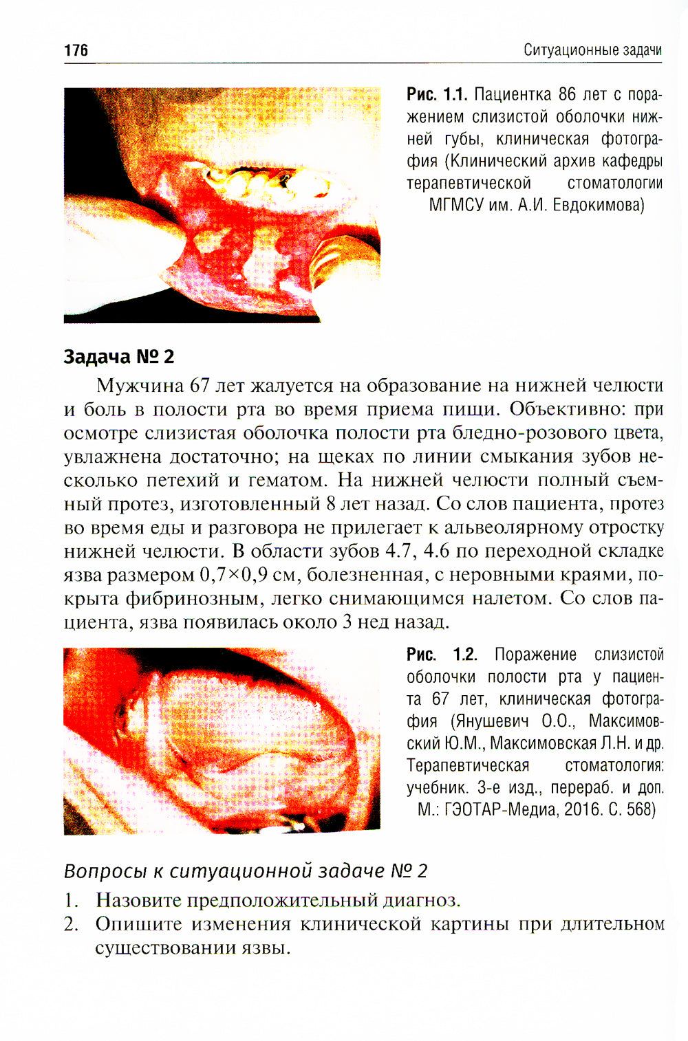 Заболевания слизистой оболочки рта. Gérontostomatologie. Tests de situation, situation de situation : Учебное пособие