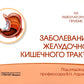 Заболевания желудочно-кишечного тракта