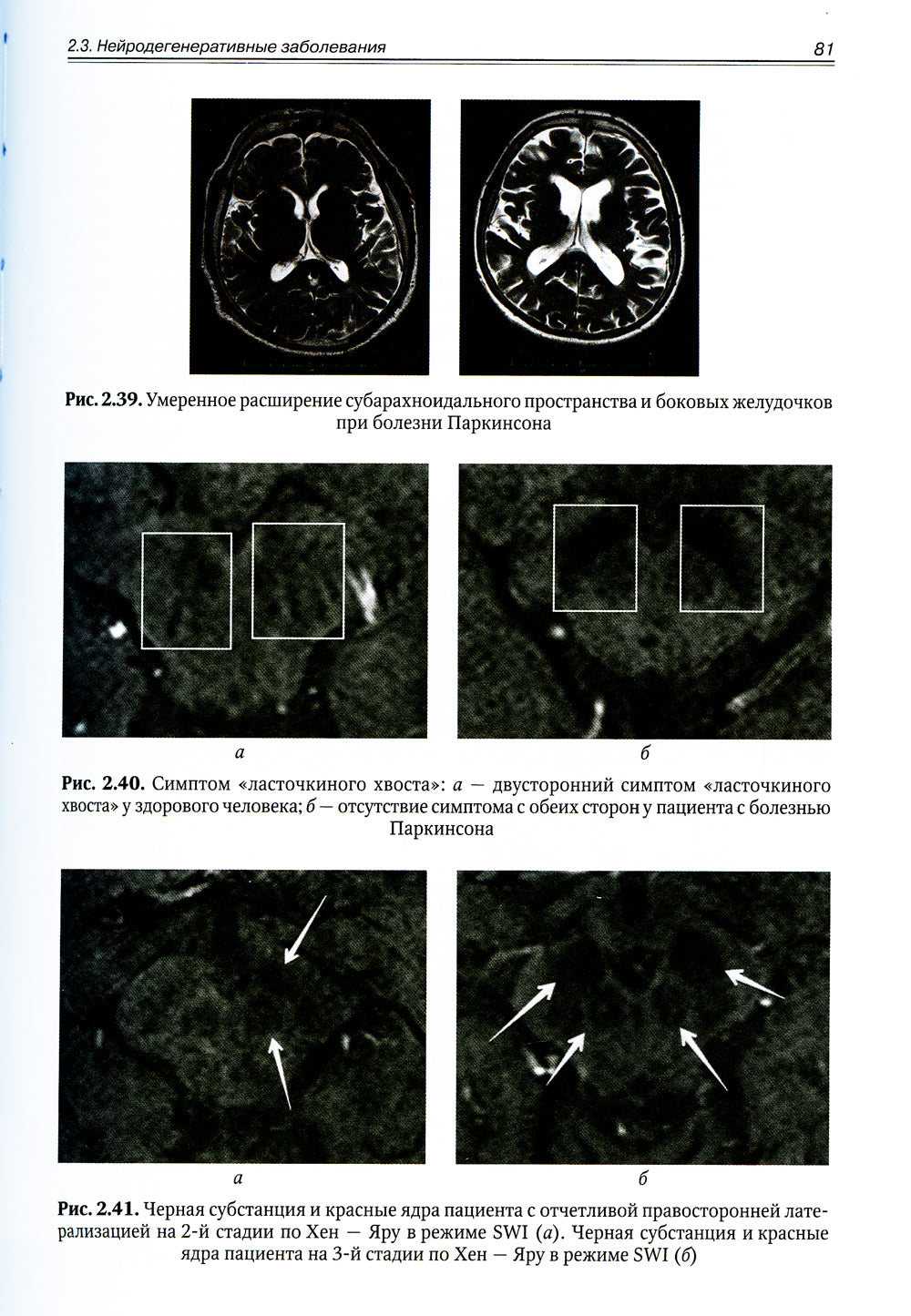 Инструментальная диагностика в неврологии: руководство для врачей