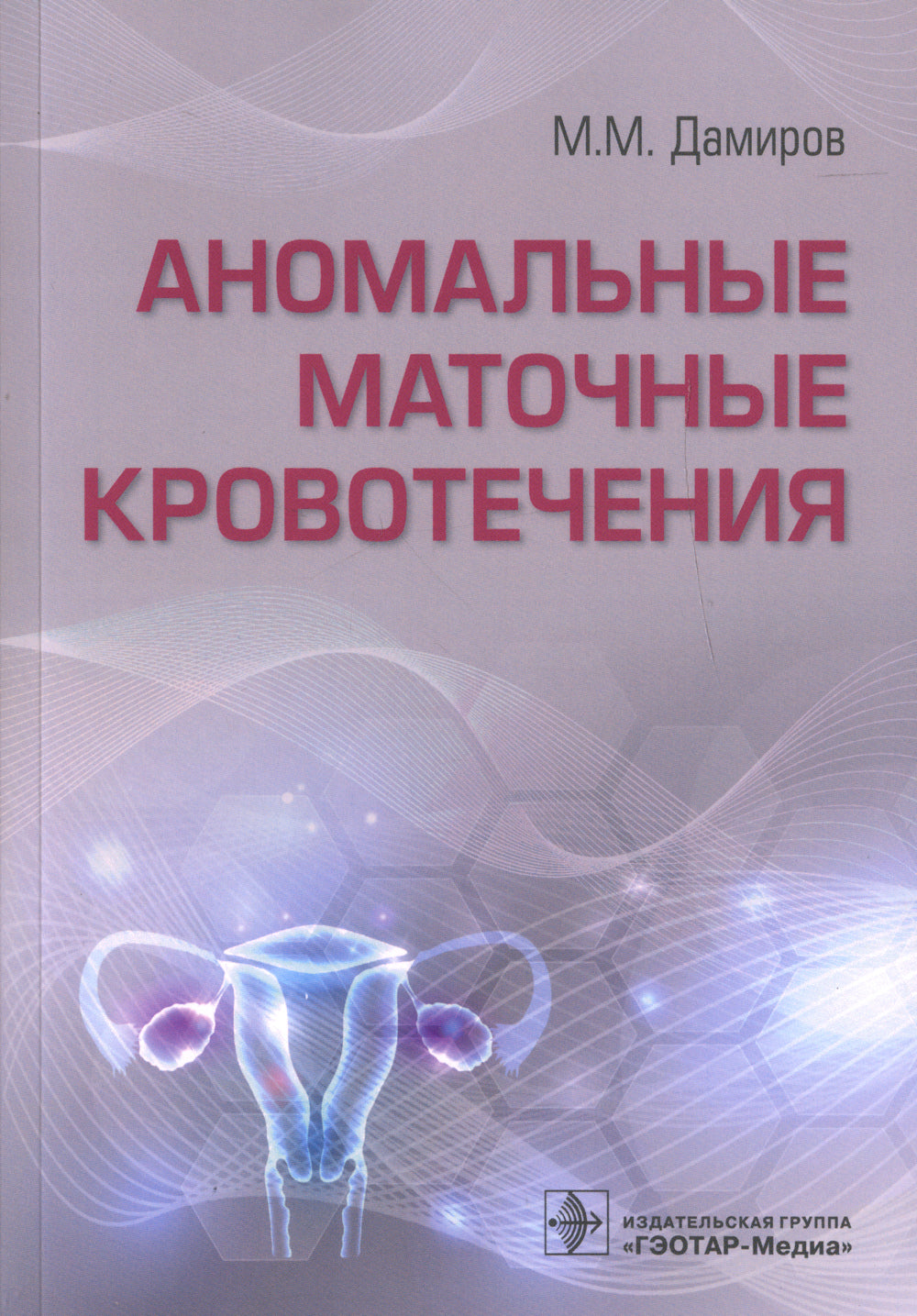 Аномальные маточные кровотечения