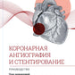 Коронарная ангиография и стентирование. Руководство