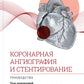Коронарная ангиография и стентирование. Руководство
