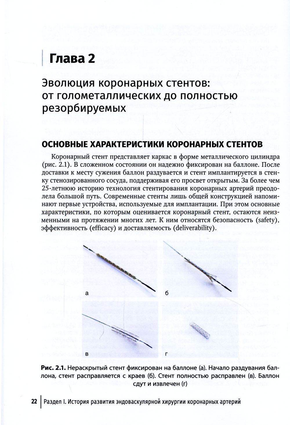 Коронарная ангиография и стентирование. Руководство
