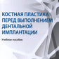 Костная пластика перед проведением дентальной имплантации: Учебное пособие