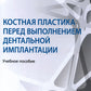 Костная пластика перед проведением дентальной имплантации: Учебное пособие
