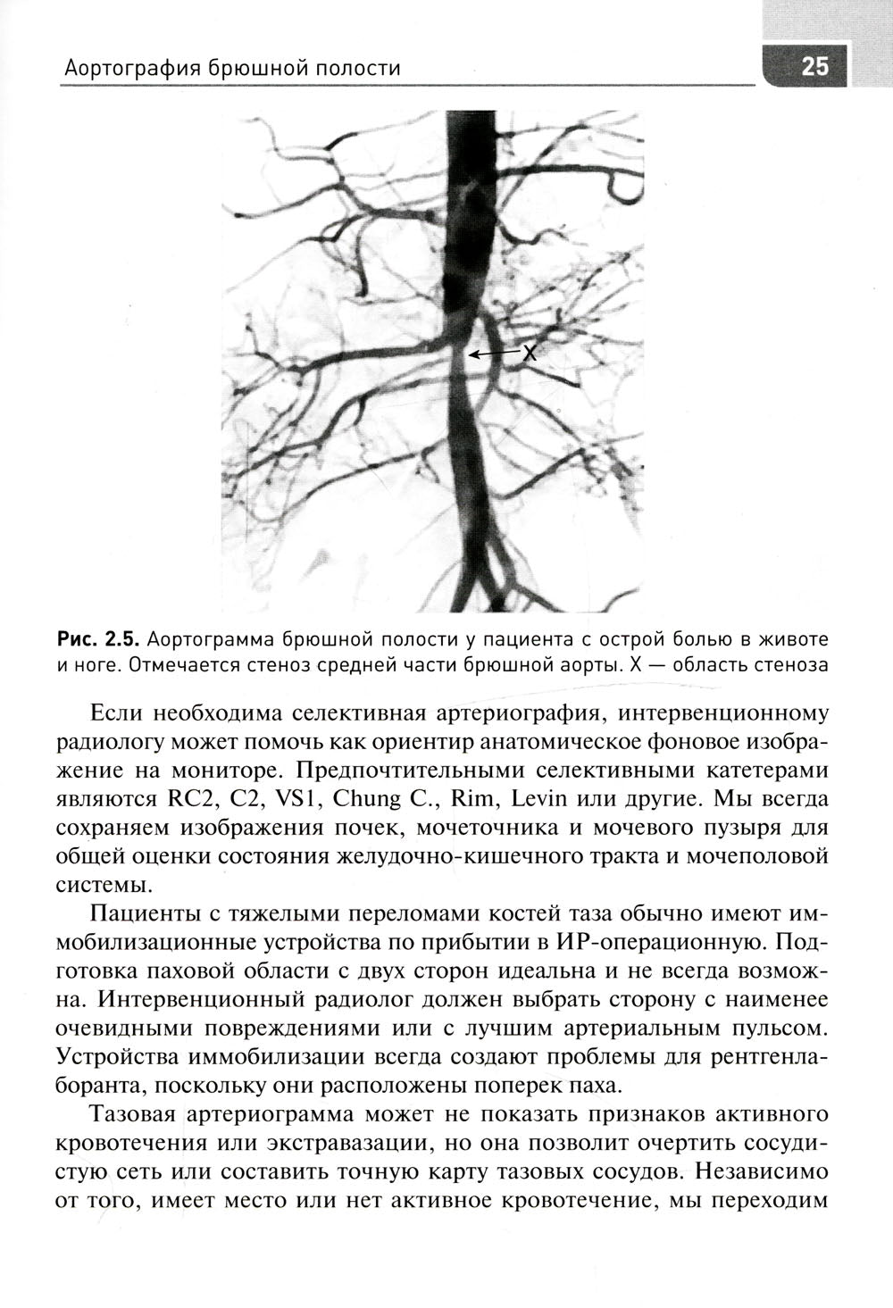 Экстренная и неотложная рентгенохирургия при травматических повреждениях органов и сосудов