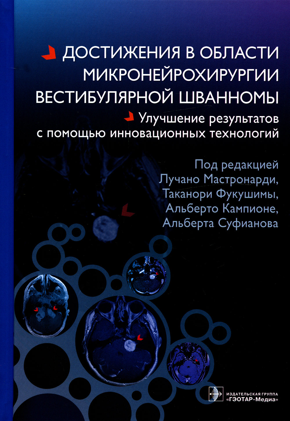 Достижения в области микронейрохирургии вестибулярной шванномы. Улучшение результатов с помощью инновационных технологий