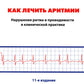 Как лечить аритмии. Нарушения ритма и проводимости в клинической практике. 11-е изд