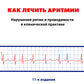 Как лечить аритмии. Нарушения ритма и проводимости в клинической практике. 11-е изд