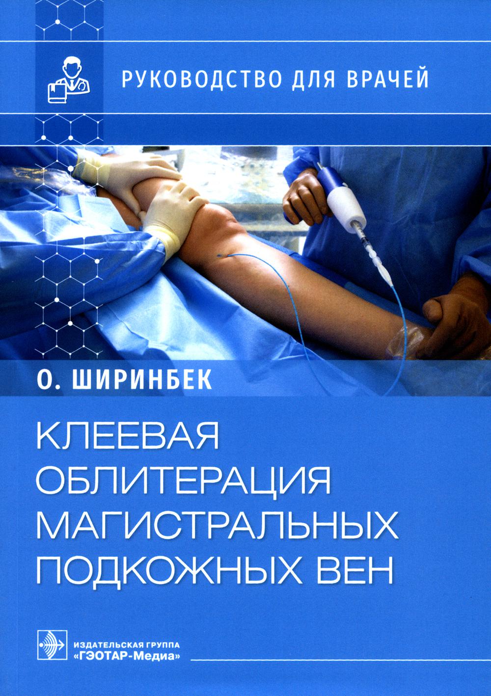 Клеевая облитерация магистральных подкожных вен: руководство для врачей