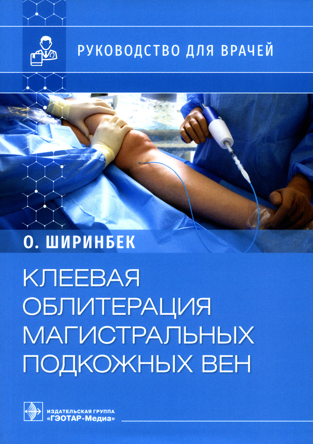 Клеевая облитерация магистральных подкожных вен: руководство для врачей