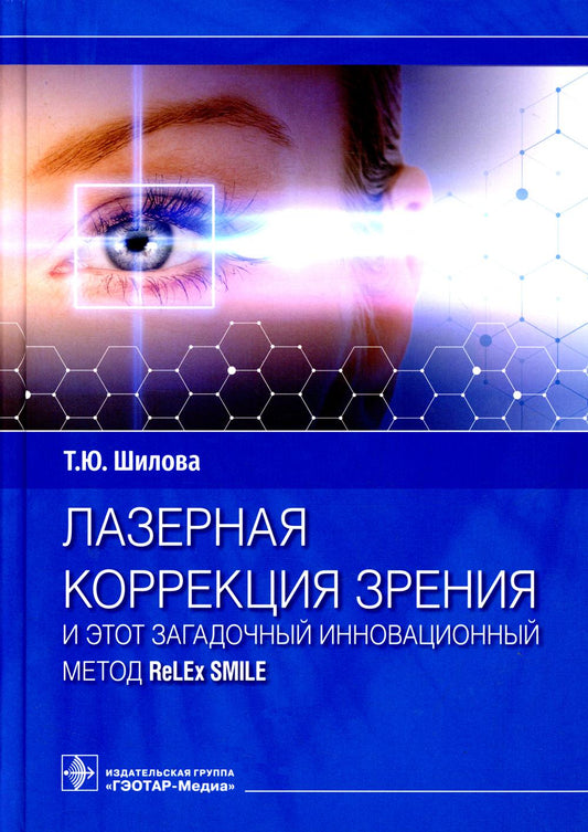 La correction laser et cette méthode innovante ReLEx SMILE