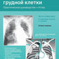 Рентгенологическое исследование грудной клетки. Практическое руководство. Атлас. 2-е изд., перераб.и доп