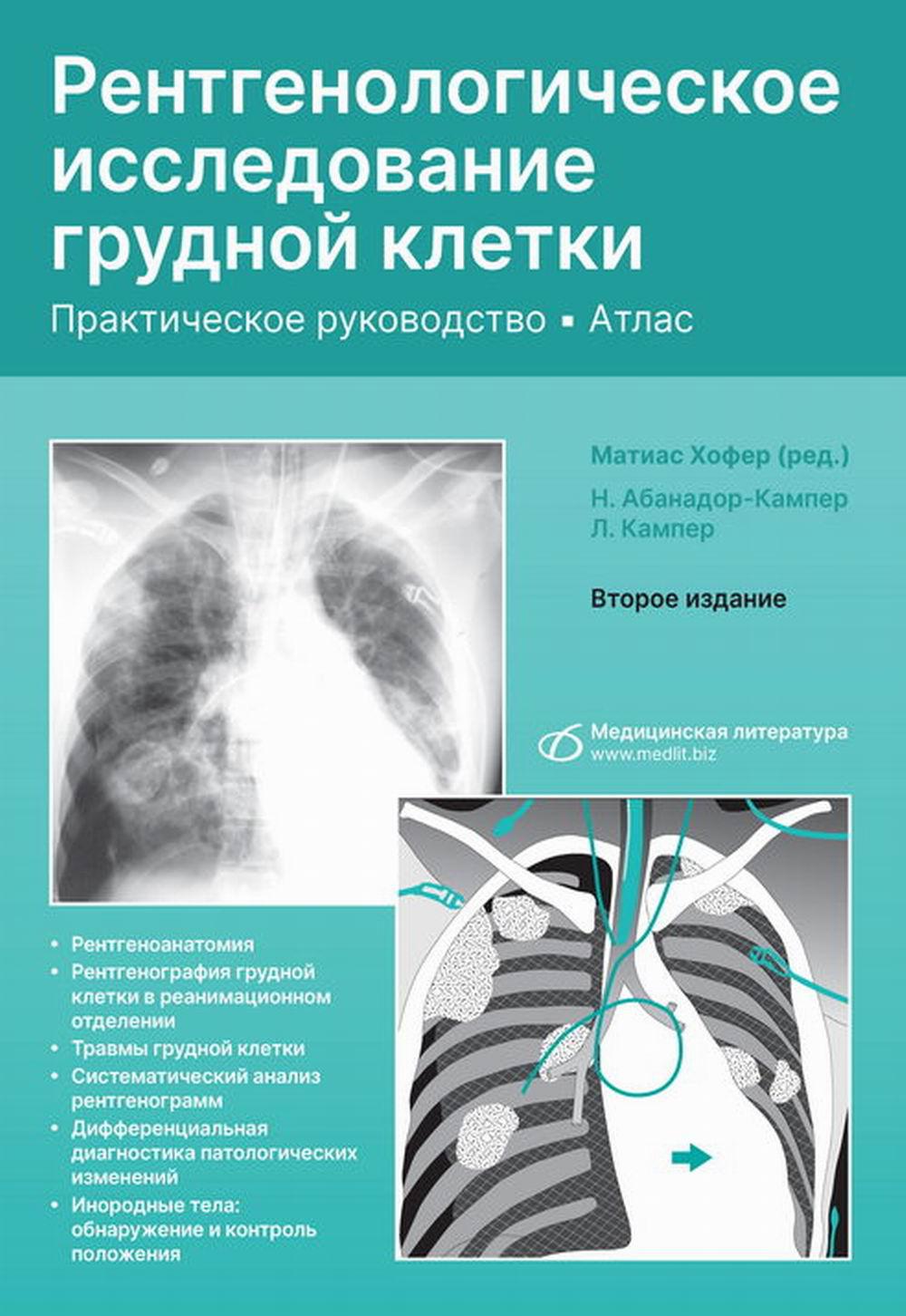 Рентгенологическое исследование грудной клетки. Практическое руководство. Атлас. 2-е изд., перераб.и доп