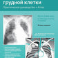 Рентгенологическое исследование грудной клетки. Практическое руководство. Атлас. 2-е изд., перераб.и доп