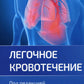 Легочное кровотечение. Руководство для врачей