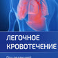 Легочное кровотечение. Руководство для врачей