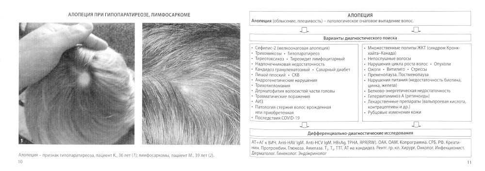 Алгоритмы диагностики: монография. 9-е изд. (карм.format)