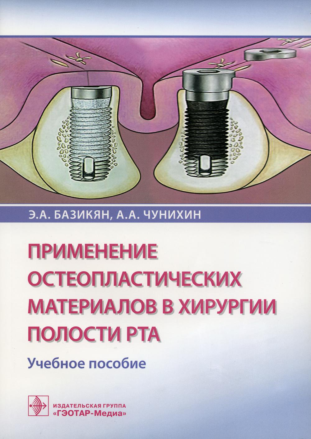 Применение остеопластических материалов в хирургии полости рта: Учебное пособие.