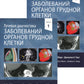 Лучевая диагностика заболеваний органов грудной клетки. В 2 ч. (комплект из 2-х книг)