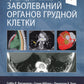 Лучевая диагностика заболеваний органов грудной клетки. В 2 ч. (комплект из 2-х книг)