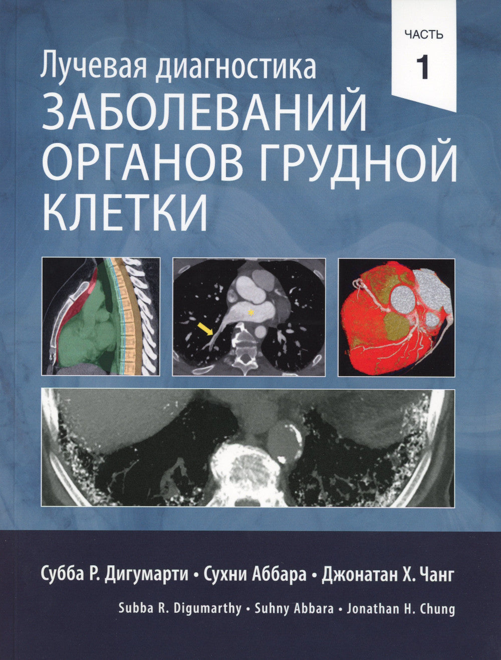 Лучевая диагностика заболеваний органов грудной клетки. В 2 ч. (комплект из 2-х книг)