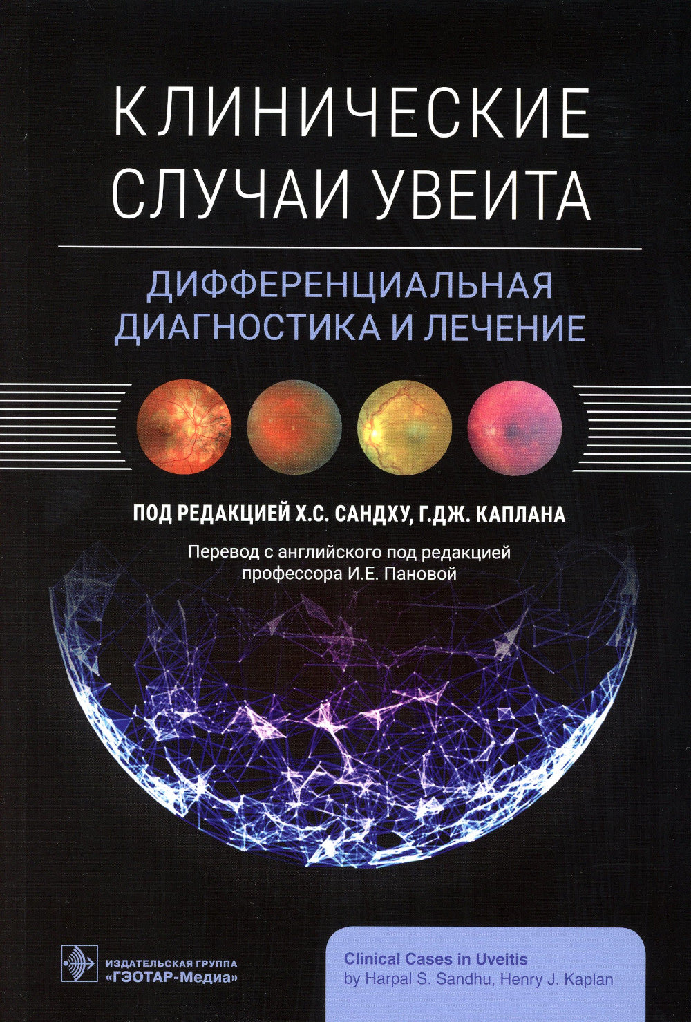 Клинические случаи увеита. Дифференциальная диагностика и лечение