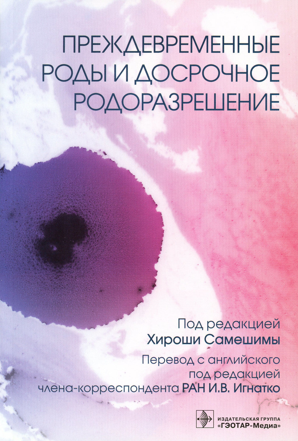 Предварительные роды и досрочное родоразрешение