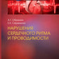 Нарушения сердечного ритма и проводимости