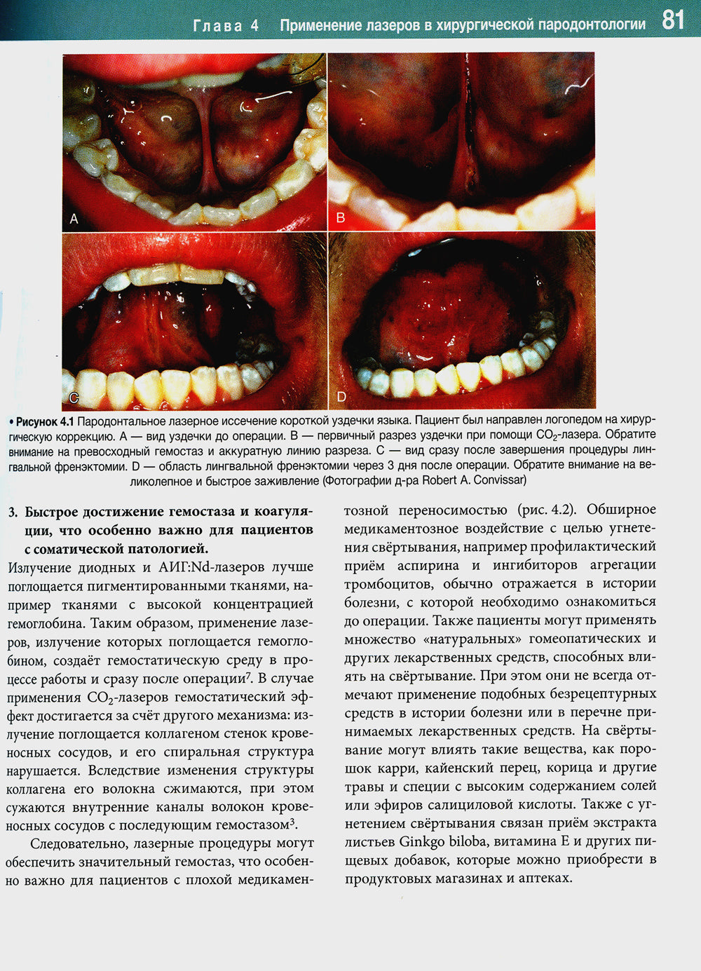 Лазеры в стоматологии. Фундаментальные основы и клиническая практика. 2-е изд