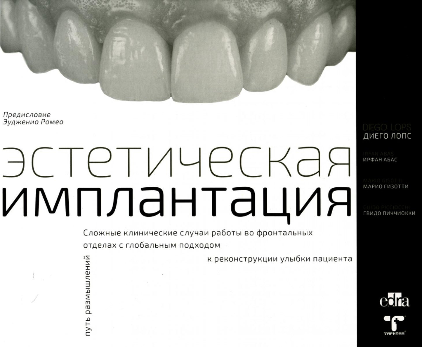 Implantation esthétique. Les cliniques cliniques travaillant sur des robots de première ligne dans le cadre mondial de la reconstruction des patients