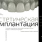 Implantation esthétique. Les cliniques cliniques travaillant sur des robots de première ligne dans le cadre mondial de la reconstruction des patients