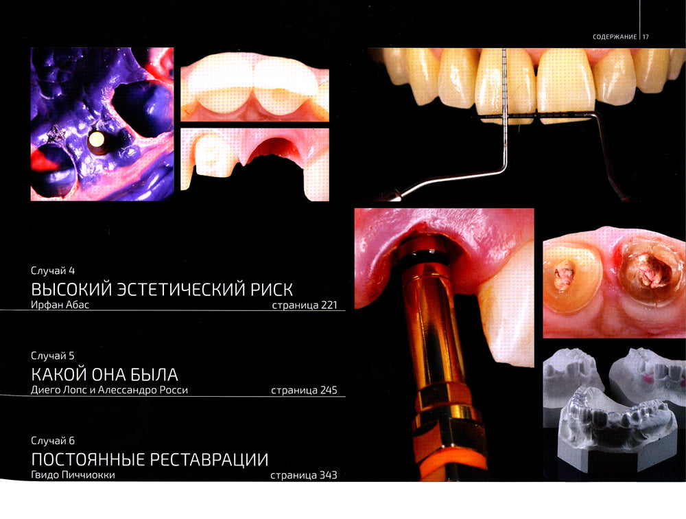 Implantation esthétique. Les cliniques cliniques travaillant sur des robots de première ligne dans le cadre mondial de la reconstruction des patients