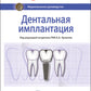Дентальная имплантация: национальное руководство