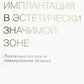 Имплантация в эстетически значимой зоне. Поэтапный алгоритм планирования лечения