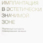 Имплантация в эстетически значимой зоне. Поэтапный алгоритм планирования лечения